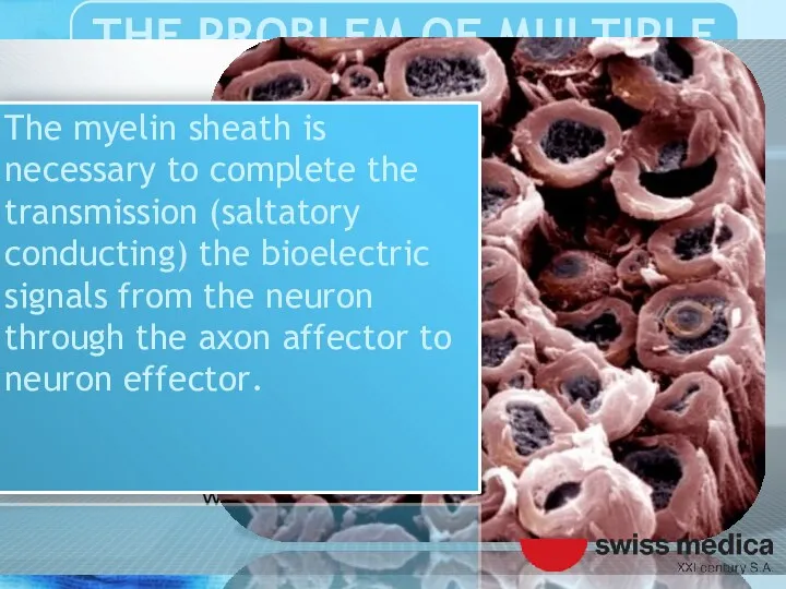 The myelin sheath is necessary to complete the transmission (saltatory
