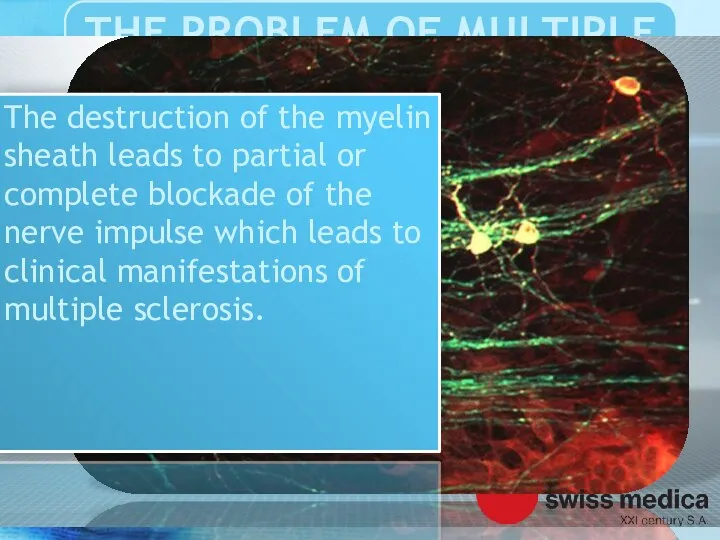 The destruction of the myelin sheath leads to partial or