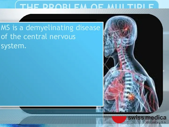 MS is a demyelinating disease of the central nervous system.