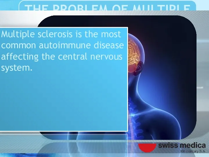 Multiple sclerosis is the most common autoimmune disease affecting the central nervous system.