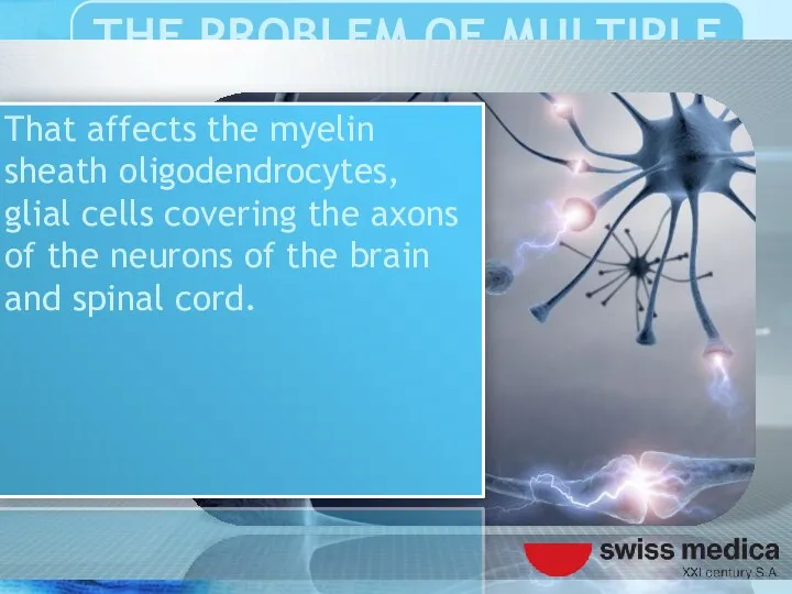 That affects the myelin sheath oligodendrocytes, glial cells covering the
