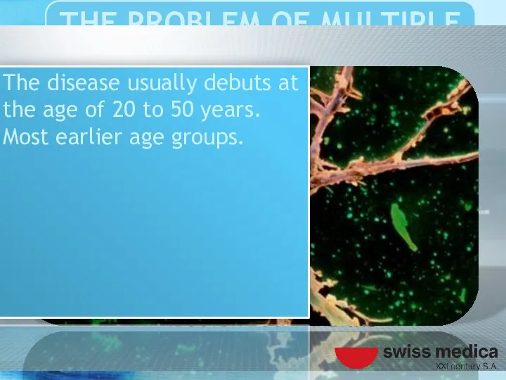 The disease usually debuts at the age of 20 to 50 years. Most earlier age groups.