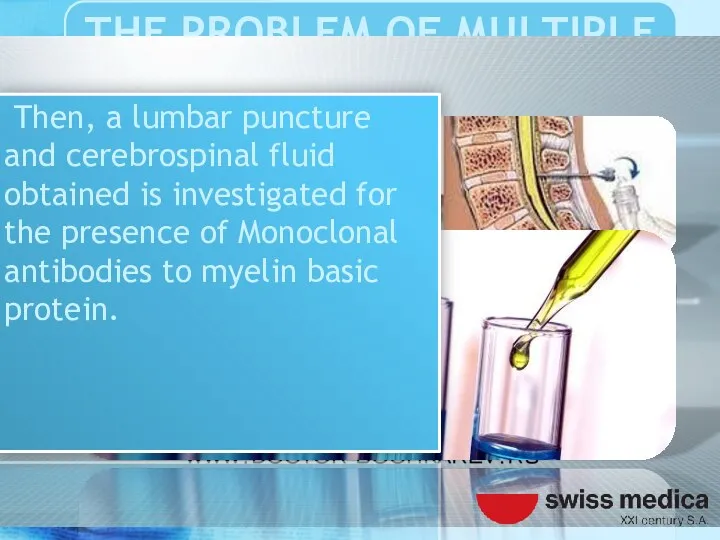 Then, a lumbar puncture and cerebrospinal fluid obtained is investigated