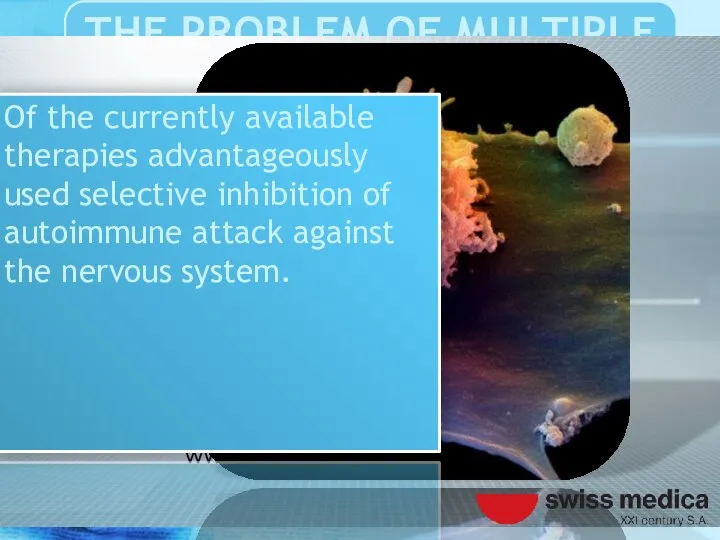 Of the currently available therapies advantageously used selective inhibition of autoimmune attack against the nervous system.