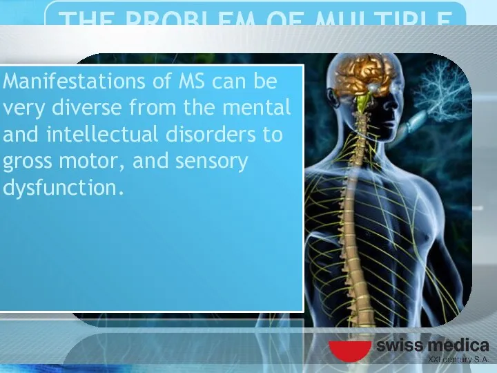 Manifestations of MS can be very diverse from the mental