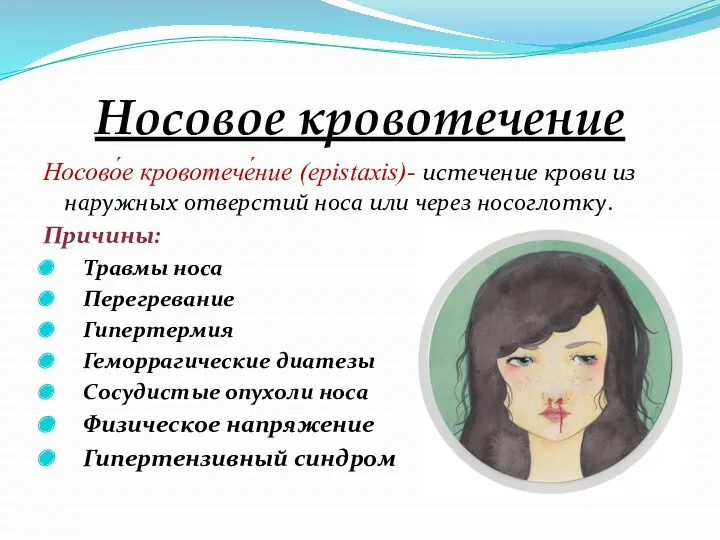 Носовое кровотечение Носово́е кровотече́ние (epistaxis)- истечение крови из наружных отверстий