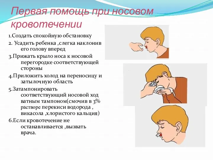 Первая помощь при носовом кровотечении 1.Создать спокойную обстановку 2. Усадить