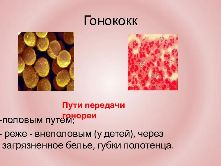 Гонококк половым путем; реже - внеполовым (у детей), через загрязненное белье, губки полотенца. Пути передачи гонореи