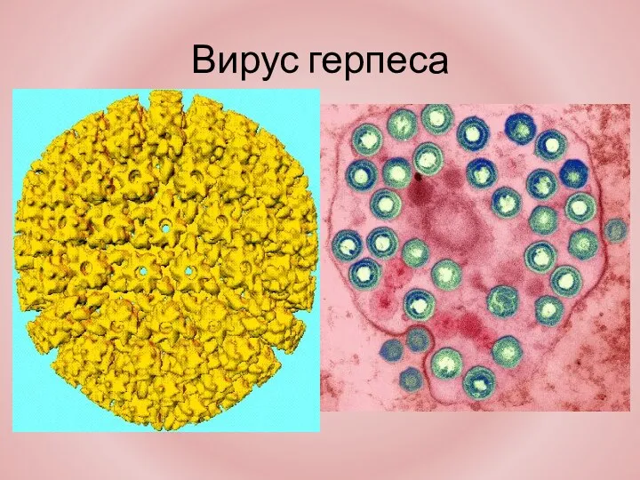 Вирус герпеса