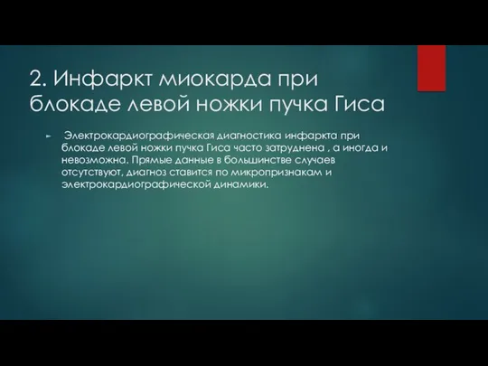 2. Инфаркт миокарда при блокаде левой ножки пучка Гиса Электрокардиографическая