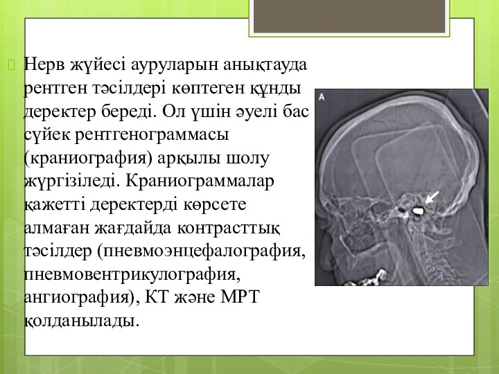 Нерв жүйесі ауруларын анықтауда рентген тәсілдері көптеген құнды деректер береді.