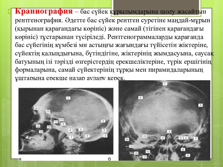 Краниография – бас сүйек құрылымдарына шолу жасайтын рентгенография. Әдетте бас