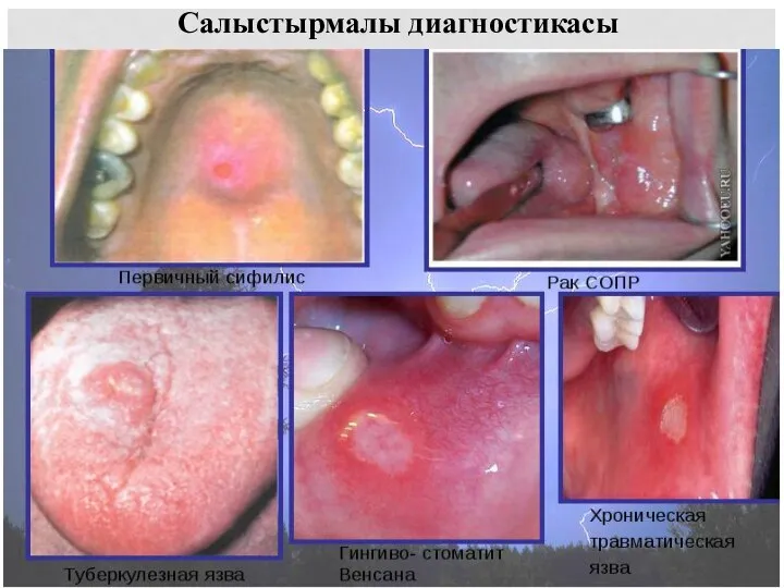 Салыстырмалы диагностикасы