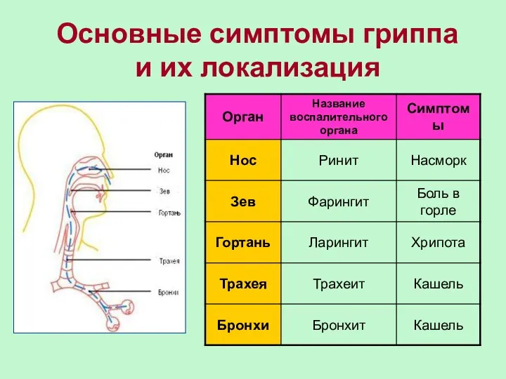 Основные симптомы гриппа и их локализация