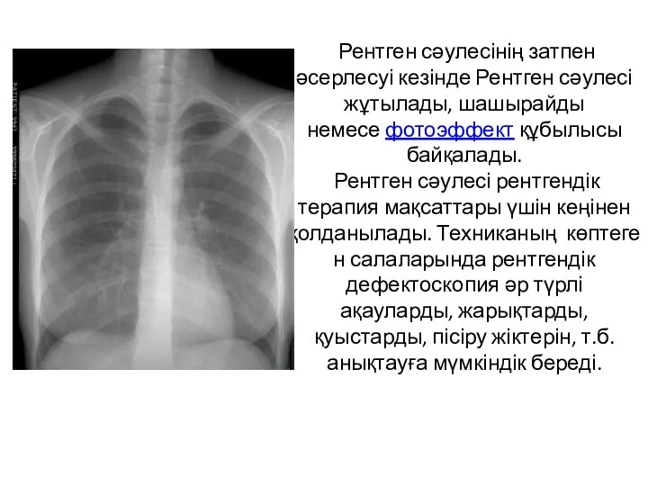 Рентген сәулесінің затпен әсерлесуі кезінде Рентген сәулесі жұтылады, шашырайды немесе