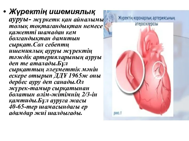 Жүректің ишемиялық ауруы- жүркетк қан айналымы толық тоқтағандықтан немесе қажетті