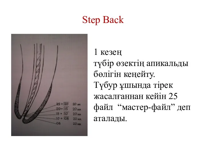 Step Back 1 кезең түбір өзектің апикальды бөлігін кеңейту. Түбур