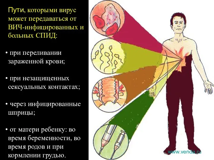 Пути, которыми вирус может передаваться от ВИЧ-инфицированных и больных СПИД: