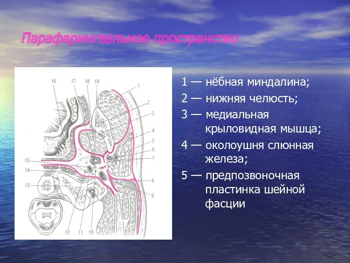 Парафарингеальное пространство 1 — нёбная миндалина; 2 — нижняя челюсть;