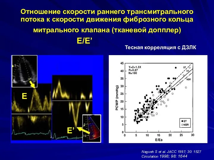 Отношение скорости раннего трансмитрального потока к скорости движения фиброзного кольца митрального клапана (тканевой