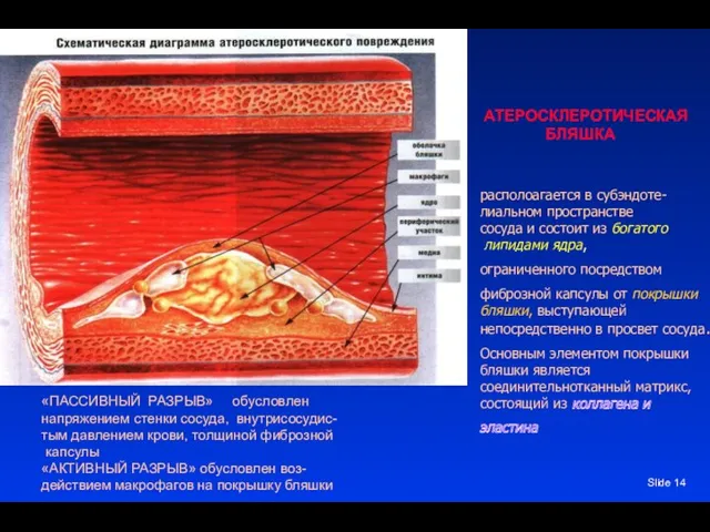 Slide располоагается в субэндоте- лиальном пространстве сосуда и состоит из