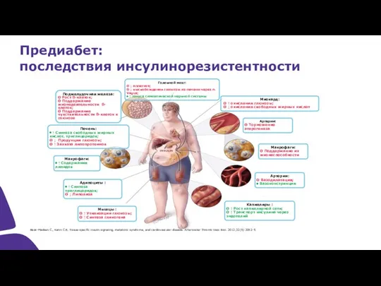 Предиабет: последствия инсулинорезистентности Поджелудочная железа: Θ Рост ß-клеток; Θ Поддержание