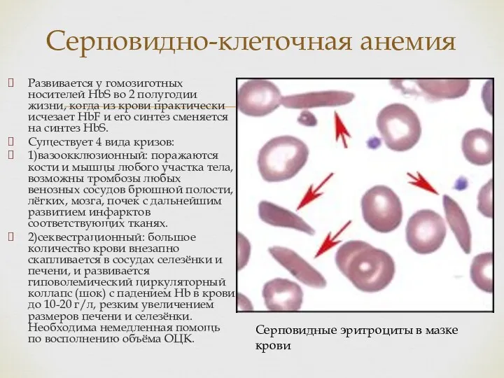 Развивается у гомозиготных носителей HbS во 2 полугодии жизни, когда из крови практически
