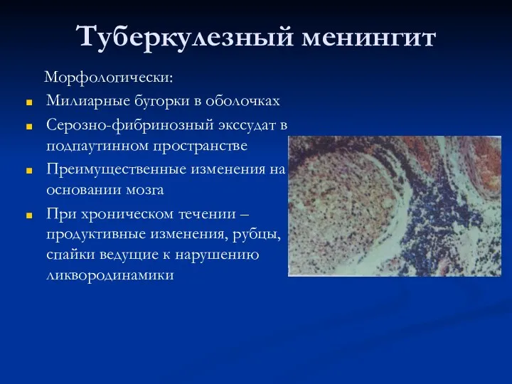 Туберкулезный менингит Морфологически: Милиарные бугорки в оболочках Серозно-фибринозный экссудат в