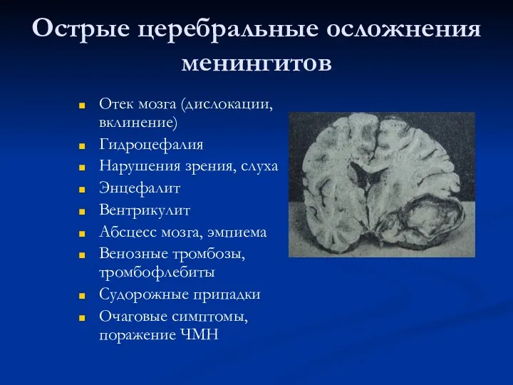 Острые церебральные осложнения менингитов Отек мозга (дислокации, вклинение) Гидроцефалия Нарушения