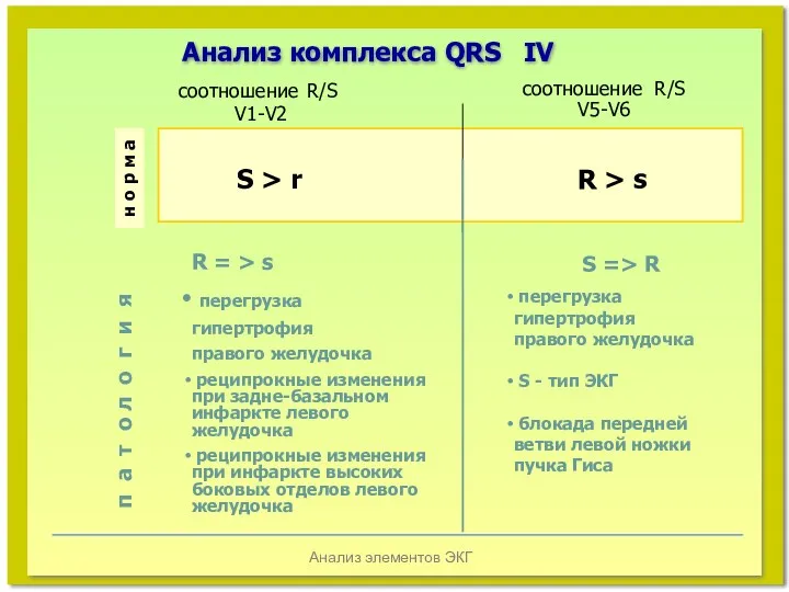 Анализ элементов ЭКГ Анализ комплекса QRS IV S > r R > s