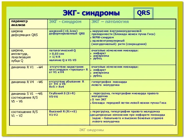 ЭКГ синдромы ЭКГ- синдромы QRS