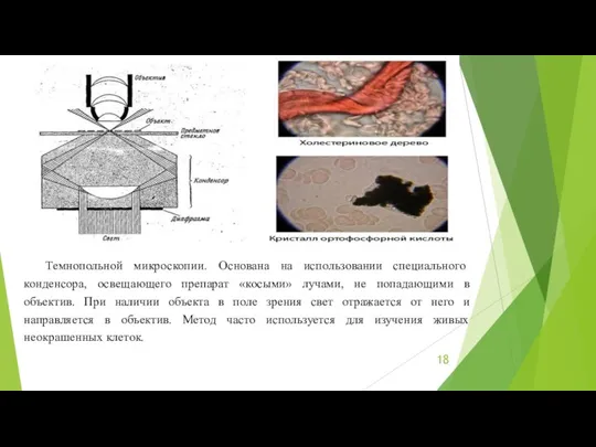 Темнопольной микроскопии. Основана на использовании специального конденсора, освещающего препарат «косыми»