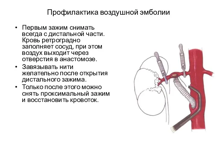 Профилактика воздушной эмболии Первым зажим снимать всегда с дистальной части.