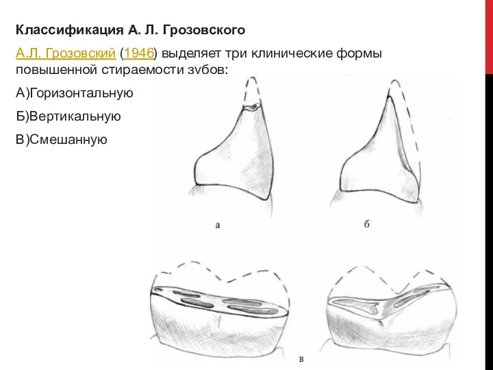 Классификация А. Л. Грозовского А.Л. Грозовский (1946) выделяет три клинические