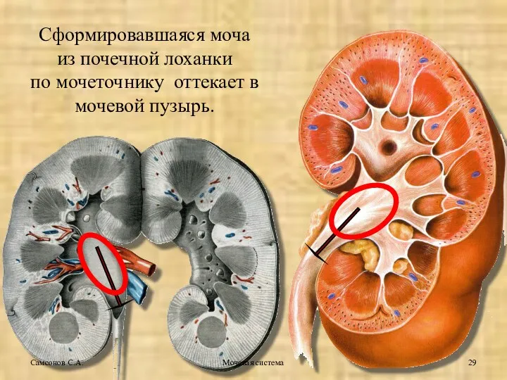 Мочевая система Самсонов С.А. Сформировавшаяся моча из почечной лоханки по мочеточнику оттекает в мочевой пузырь.