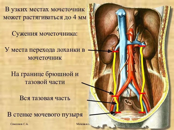 Мочевая система Самсонов С.А. В узких местах мочеточник может растягиваться