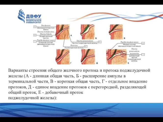 Варианты строения общего желчного протока и протока поджелудочной железы (А
