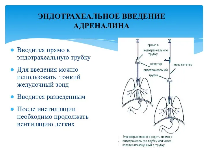 ЭНДОТРАХЕАЛЬНОЕ ВВЕДЕНИЕ АДРЕНАЛИНА Вводится прямо в эндотрахеальную трубку Для введения