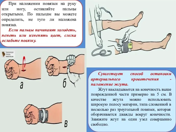 При наложении повязки на руку или ногу, оставляйте пальцы открытыми. По пальцам вы