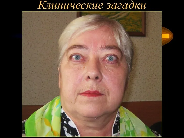 Клинические загадки