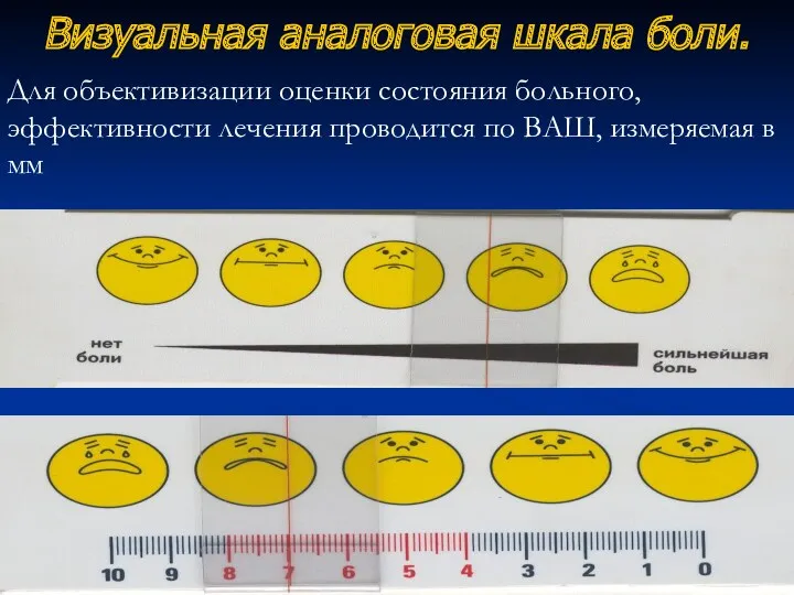 Визуальная аналоговая шкала боли. Для объективизации оценки состояния больного, эффективности