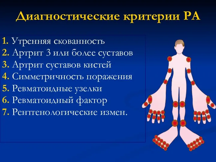 1. Утренняя скованность 2. Артрит 3 или более суставов 3.