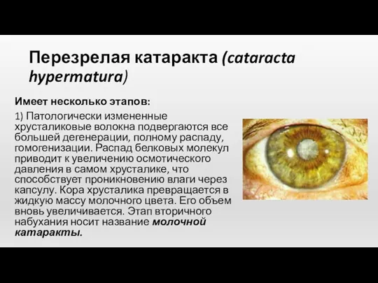 Перезрелая катаракта (cataracta hypermatura) Имеет несколько этапов: 1) Патологически измененные хрусталиковые волокна подвергаются