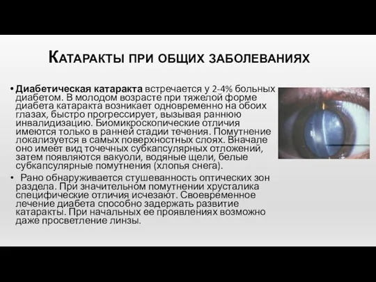 Катаракты при общих заболеваниях Диабетическая катаракта встречается у 2-4% больных диабетом. В молодом