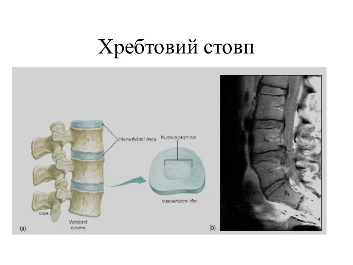 Хребтовий стовп