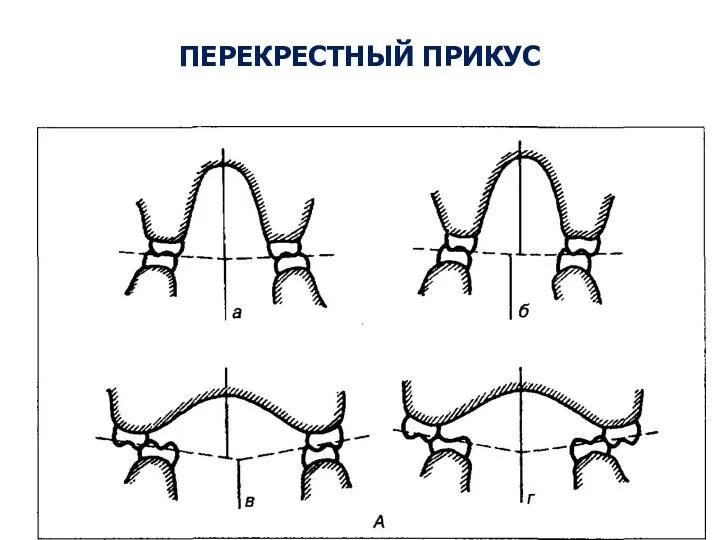 ПЕРЕКРЕСТНЫЙ ПРИКУС