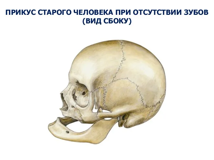 ПРИКУС СТАРОГО ЧЕЛОВЕКА ПРИ ОТСУТСТВИИ ЗУБОВ (ВИД СБОКУ)