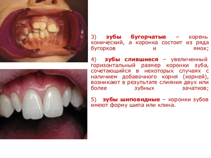 3) зубы бугорчатые – корень конический, а коронка состоит из