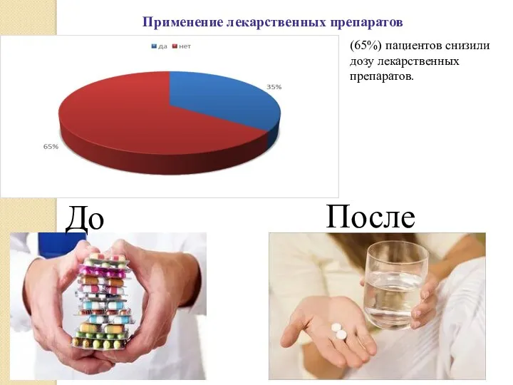 Применение лекарственных препаратов (65%) пациентов снизили дозу лекарственных препаратов. До После