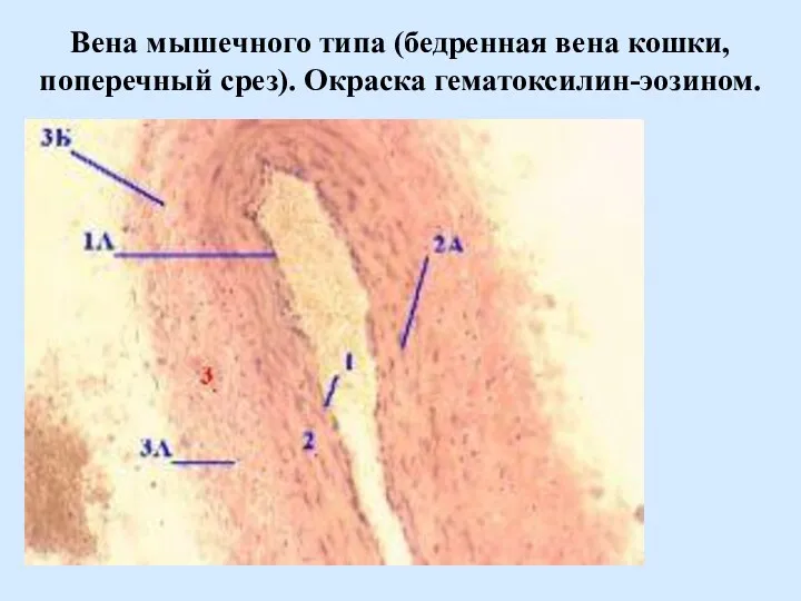 Вена мышечного типа (бедренная вена кошки, поперечный срез). Окраска гематоксилин-эозином.